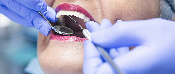 Best Emergency Dental Care for Broken or Chipped Teeth in Youngsville, PA